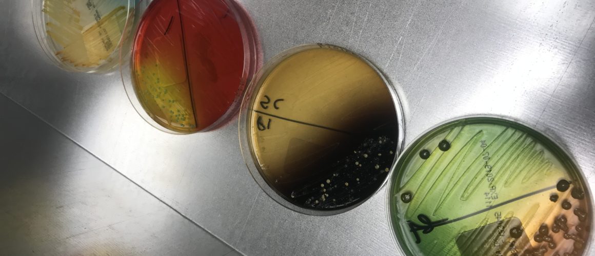 VDL Agar Diagonal